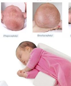 כרית ליציבות ראש התינוק - למניעת 